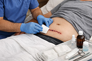 Αλλαγή και περιποίηση μετεγχειρητικών τραυμάτων στο σπίτι